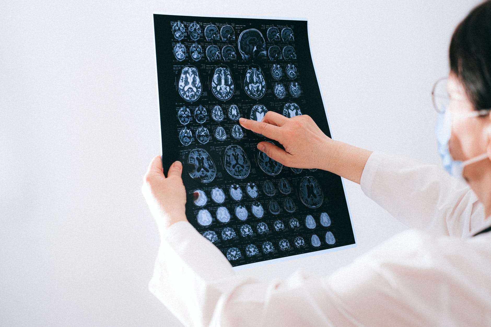 Искусственный интеллект сможет диагностировать деменцию за один день